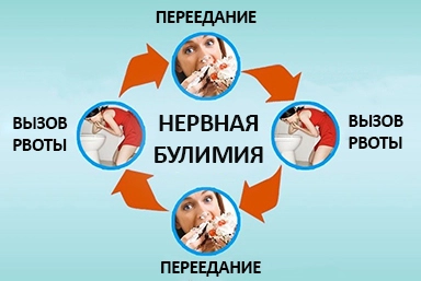 Лечение булимии в Сухиничах